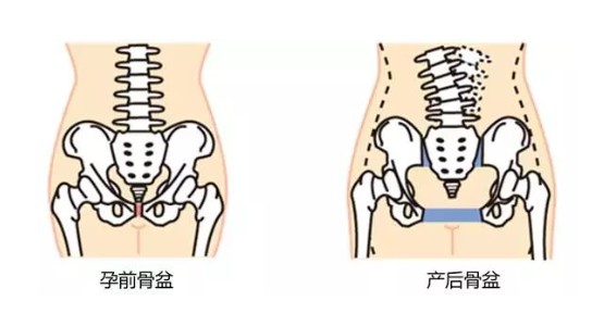 “产后恢复”要恢复什么？