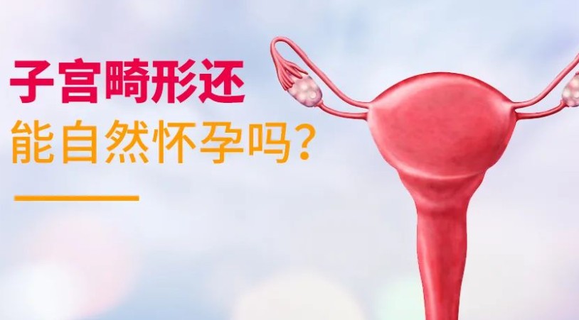 子宫畸形还能自然怀孕吗？