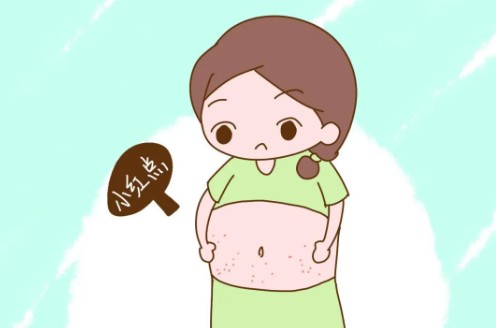 妊娠纹是每个孕妇都会长的吗？