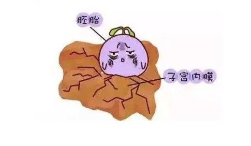 慢性子宫内膜炎能怀孕吗？