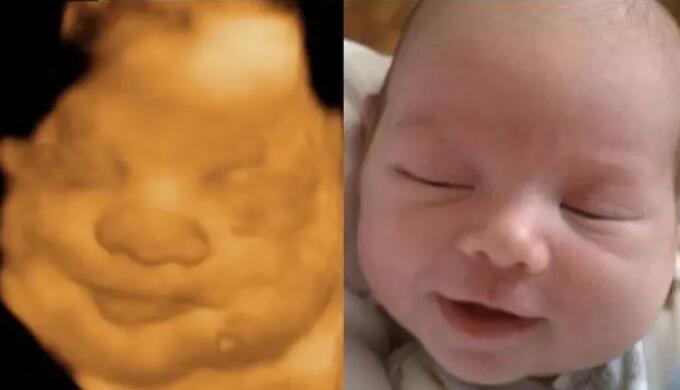 准妈妈必看！香港邮寄验血全攻略：条件、流程、结果时效，避开这些误区