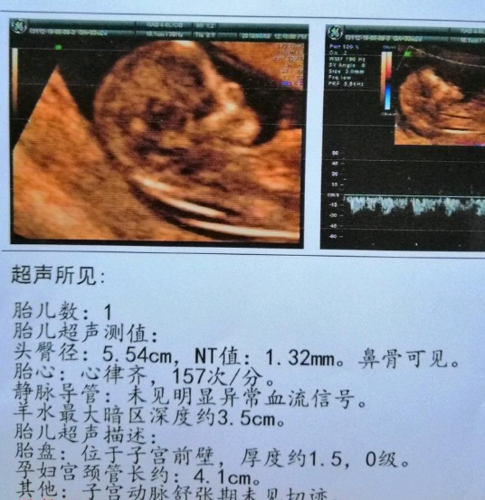 QQ浏览器截图20250305103213.png